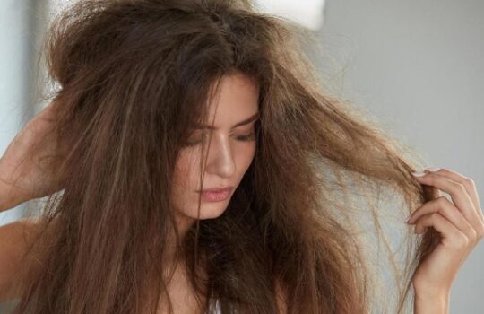 Cara Mengatasi Rambut Kering dan Kusut