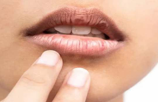 Cara Mudah Atasi Bibir Kering di Musim Kemarau